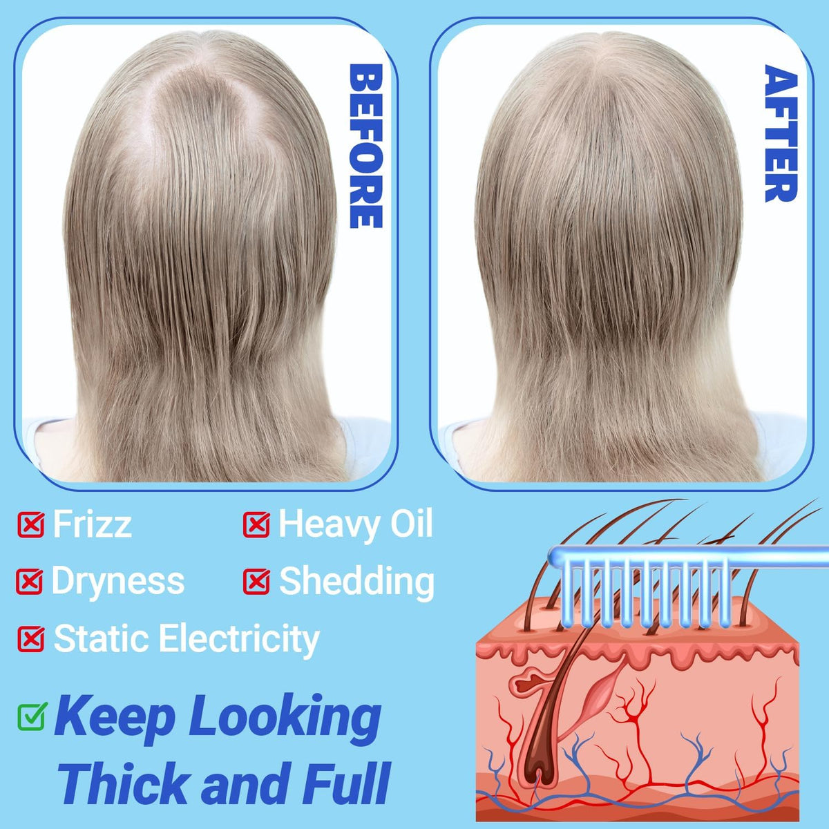 Radio Frequency Neon + Argon - Remove Wrinkles, Inflammation, Acne, Pores by stimulating the production of new collagen and elastin and help to grow hairs